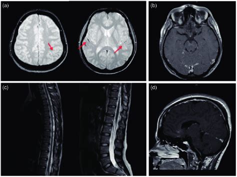Axial And Sagittal Magnetic Resonance Imaging Mri Images Of The Brain
