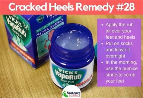 30 Amazing Home Remedies For Dry Cracked Feet The Fitness Tribe