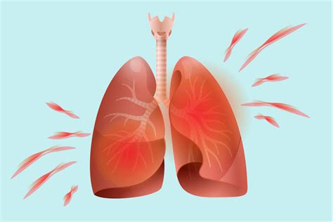 Lung Disease Can Be Deadly For Rheumatoid Arthritis Patients