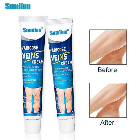 Varicose Veins Cream Promoting Blood Circulations Pain Relief Ointment