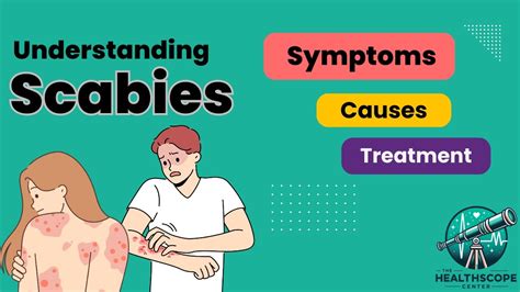 Scabies Everything You Need To Know Youtube