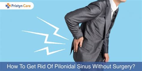 16 Effective Home Remedies For Pilonidal Cyst Pristyn Care