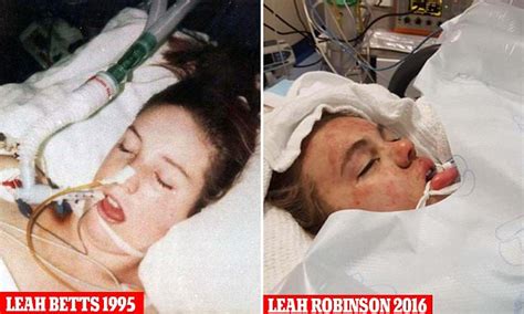 Wigan Girl In Coma After Ecstasy Overdose Daily Mail Online