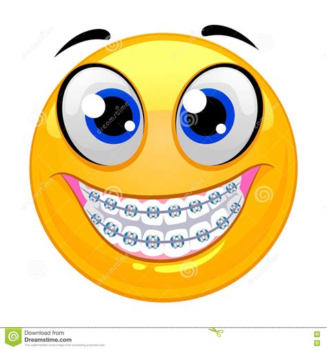 Smiley Emoticon Showing Teeth With Braces Stock Vector Illustration
