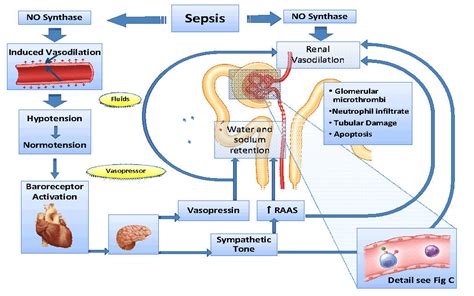 Sepsis is a syndromic response to infection and is frequently a final common pathway to death from significant regional disparities in sepsis incidence and mortality exist; Sepsis & AKI