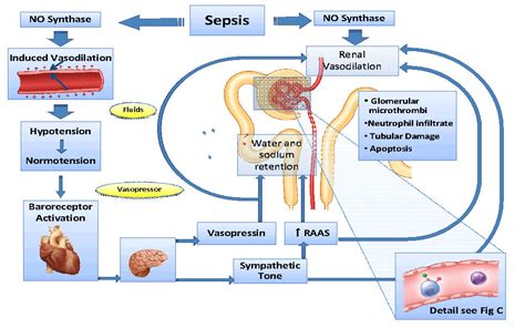 This is a dramatic drop in blood pressure that can lead to sepsis and septic shock. Sepsis & AKI