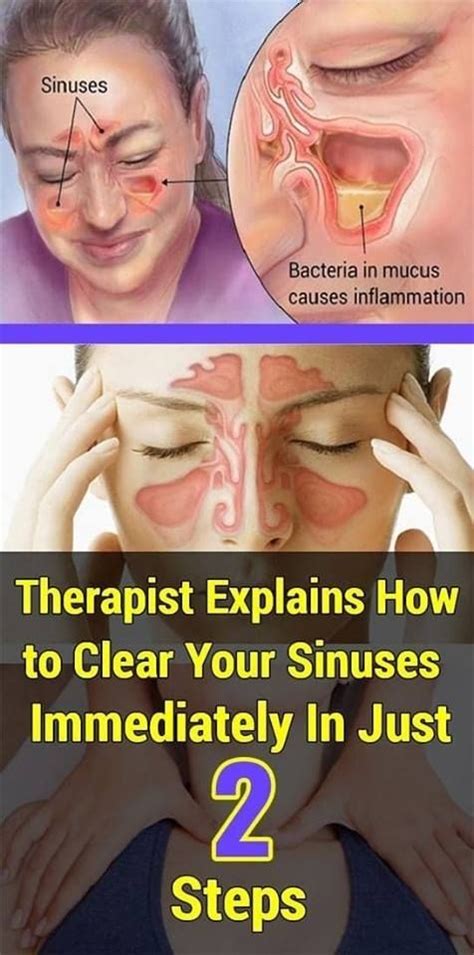 Therapist Explains How To Clear Your Sinuses Immediately In Just Two Steps How To Clear