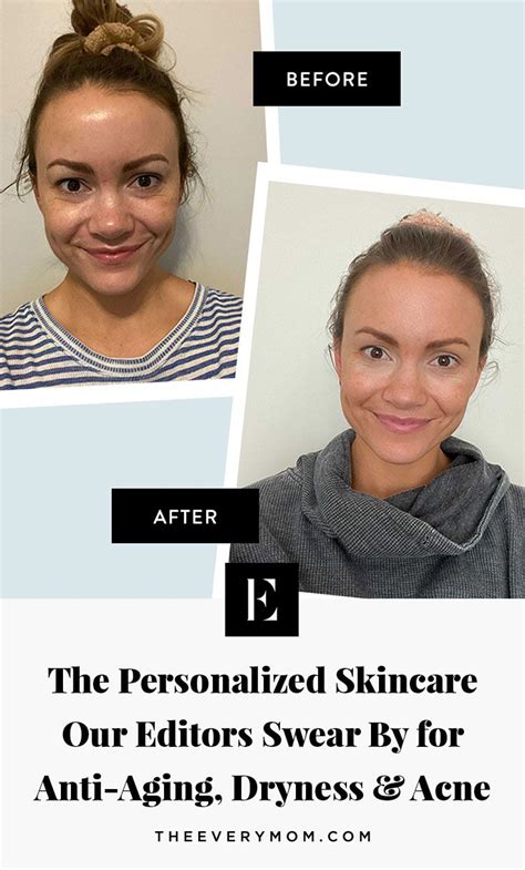 Check Out How Three Of Our Editors With Different Skin Types And