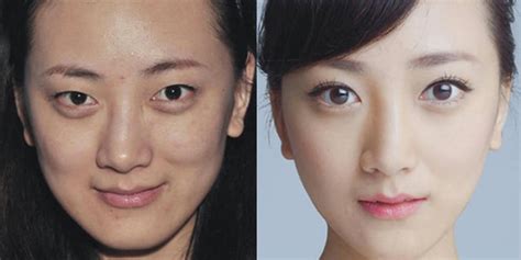 Extreme Plastic Surgery Causes Passport Confusion Popsugar Beauty Photo 6