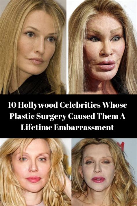 Check Out The Before And After Plastic Surgery Pictures Of These 10