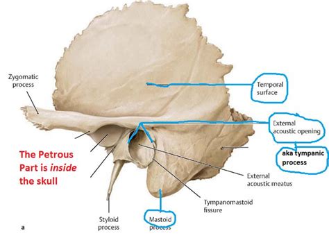 Temporal Bone Medical Anatomy Anatomy Anatomy Bones