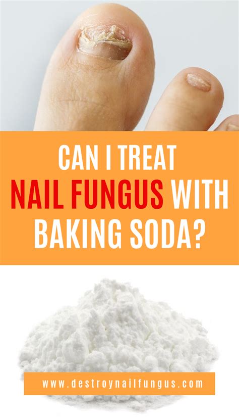 Can I Treat Nail Fungus With Baking Soda Toenail Fungus Home