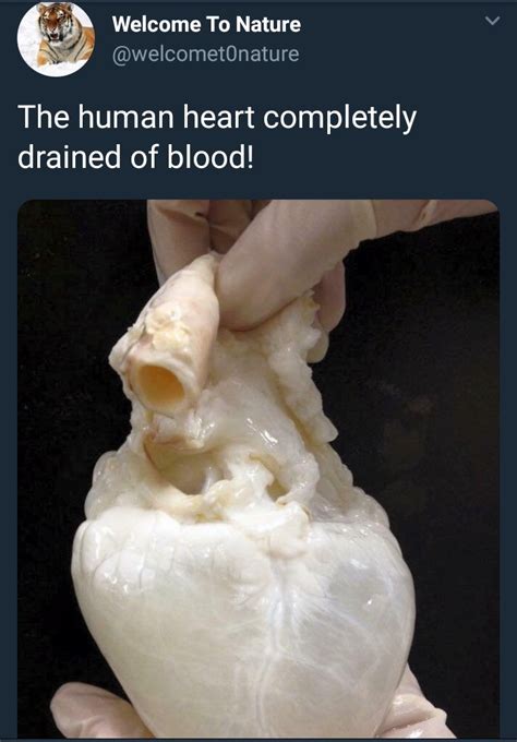 See What The Human Heart Looks Like When It Is Completely Drained Of