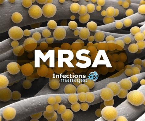 Mrsa Causes And Symptoms Pictures Symptoms Treatment And Prevention