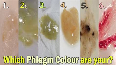 What Does The Color Of My Phlegm Means Yellow Brown Green Yellow