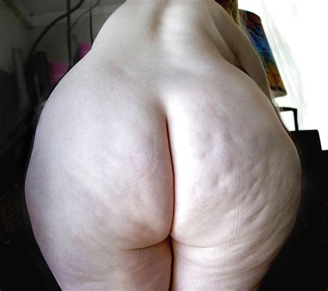 Fat Cellulite Ass