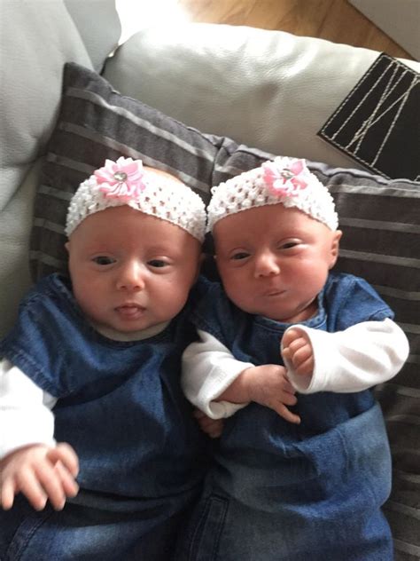 these identical twins are a picture of health but medics wanted to let one die mirror online
