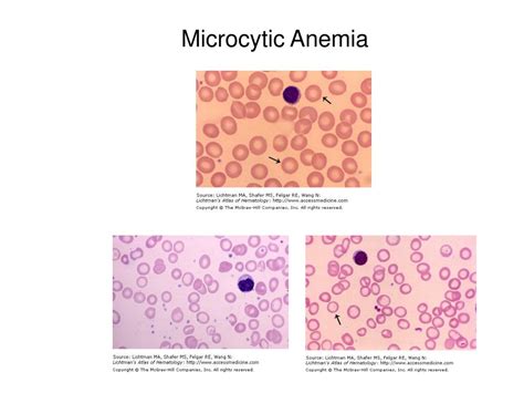 Ppt Hematopoietic And Anti Anemia Agents Powerpoint Presentation