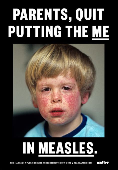 Measles Is Just The Beginning We Treat It Like A Pest But Its One By Leigh Cowart Matter