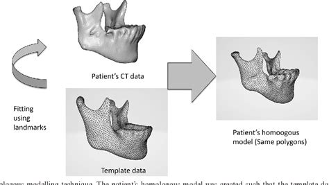 Figure 1 From Examination Of New Parameters For Sex Determination Of Mandible Using Japanese