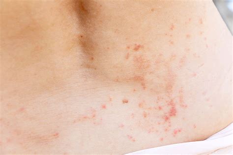 Got Sensitive Skin The 20 Most Common Skin Irritants You Must Avoid
