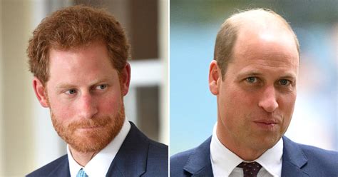 Prince Harry Prince William Balding Is Alarming And Advanced