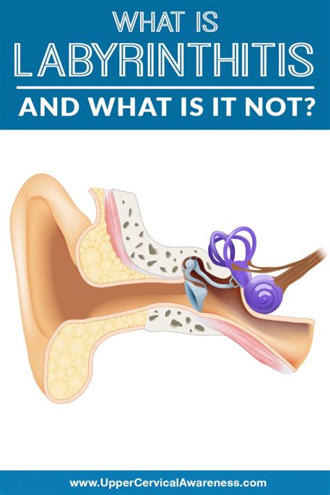 Labyrinthitis And What Is It Not Img Upper Cervical Awareness