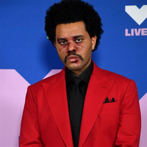Full Story Behind The Weeknds Face Bandages At Super Bowl Lv