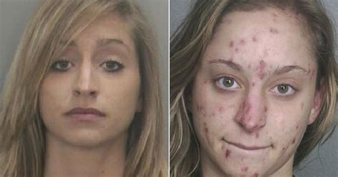 Horror Before And After Mugshots Show Devastating Impact Of Meth