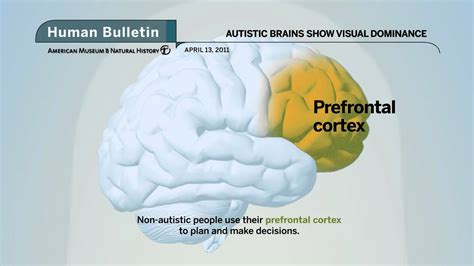 Science Bulletins Autistic Brains Show Visual Dominance Youtube