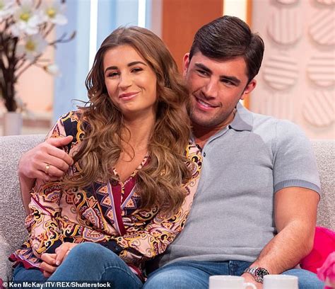 Love Islands Jack Fincham 29 Reveals Hes Had A Hair Transplant To Cover Up Scar Readsector