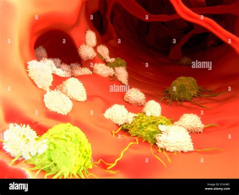 Artwork Of T Lymphocytes Attacking Cancer Cells Stock Photo Alamy