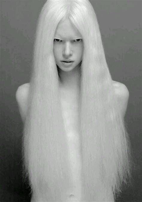 albino albino model albino girl albinism