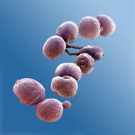 Streptococcus Pneumoniae Bacteria Sem Photograph By Ami Images Fine
