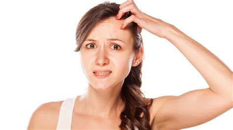 Do You Always Have An Itchy Head Find Out The Causes And Possible