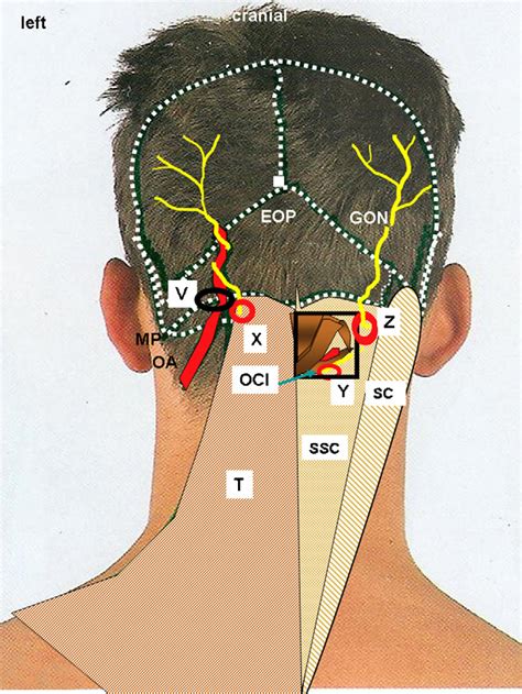 Occipital Nerve Block Anatomy