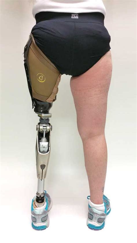 Home Prosthetic Leg Prosthetics Legs