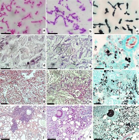 Microphotographs Of H Capsulatum Yeast Cells Strain Imthc128