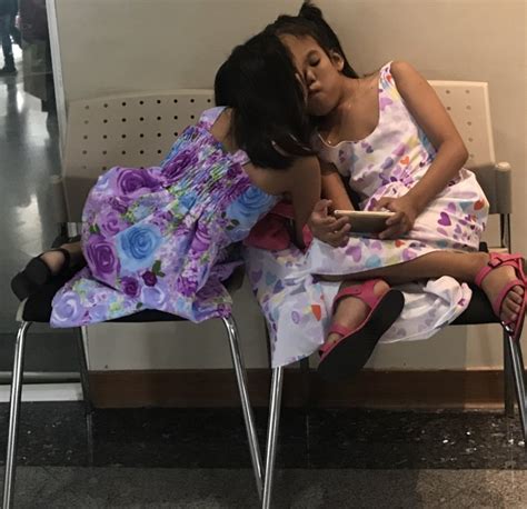 Conjoined Twins Prepare For Separation Surgery That May Only Save One