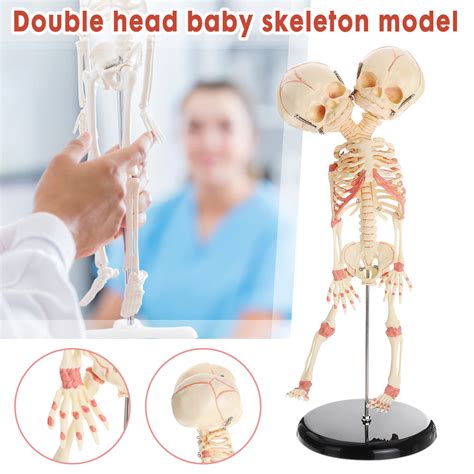 Double Head Baby Anatomy Skull Skeleton Anatomical Brain Anatomy Educa
