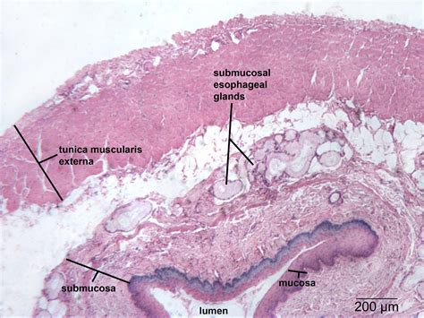 At the outer regions of the section, you can see a dense, thick layer of compact bone. Digestive | NP Histology
