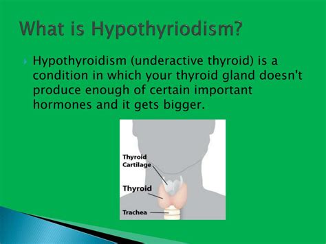 Ppt Hypothyroidism Powerpoint Presentation Free Download Id2206775