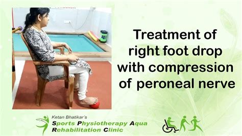 Treatment Of Right Foot Drop With Compression Of Peroneal Nerve Youtube
