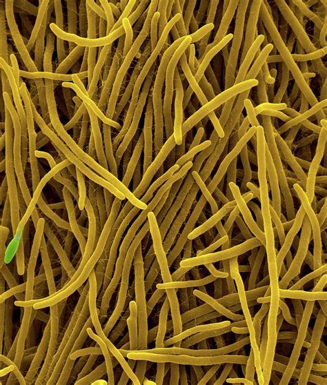 Fungus Acremonium Sclerotigenum Photograph By Dennis Kunkel Microscopy