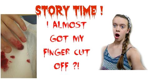 Storytime I Got My Finger Cut Off Youtube