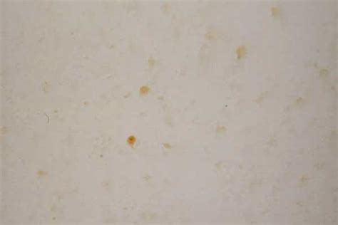 Are there any health risks associated with having it in your home if you encounter brown mold in your home, you're likely wondering what its colour and. how to clean mold from bathroom ceiling