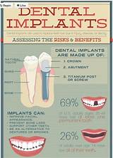 Pictures of Park Oral Surgery San Diego