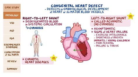 Common Types Of Congenital Heart Defects Children S Health Vrogue