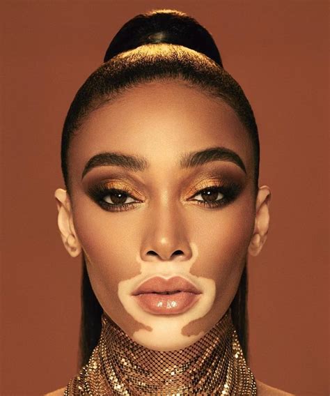 Emo Cunt⁷ On Twitter Vitiligo Model Winnie Harlow Black Female Model
