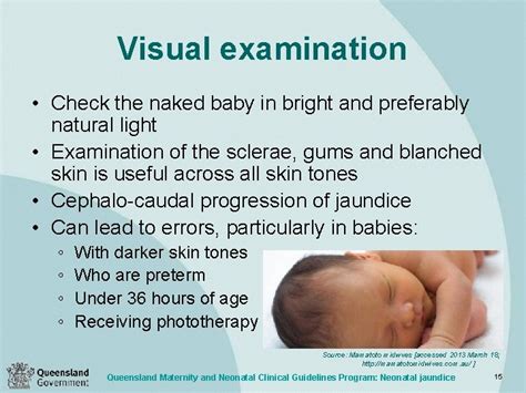 Neonatal Jaundice Clinical Guideline Education Presentation V 2